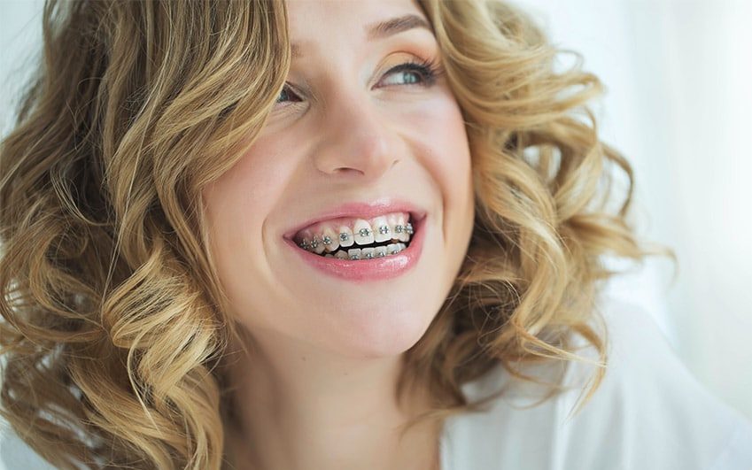 Beauty Dental - địa chỉ niềng răng trả góp Hà Nội uy tín được hàng trăm khách hàng tin yêu