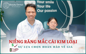 Niềng răng mắc cài kim loại - sự lựa chọn hoàn hảo về giá