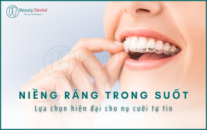 Niềng răng trong suốt - lựa chọn hiện đại cho nụ cười tự tin