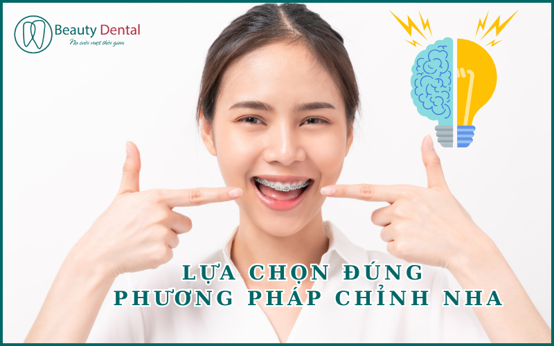 Đúng thầy - đúng phương pháp chỉnh nha - thăng hạng nụ cười hoàn mỹ