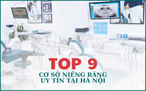 Top 9 cơ sở niềng răng uy tín tại Hà Nội