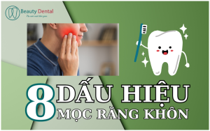 8 dấu hiệu mọc răng khôn bạn đã biết chưa