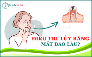 Điều trị tủy răng mất bao lâu