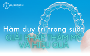 Hàm duy trì trong suốt - giải pháp thẩm mỹ hiệu quả