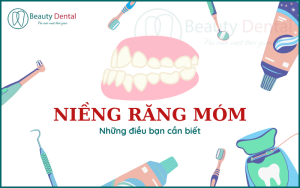 Niềng răng móm và những điều bạn có thể chưa biết