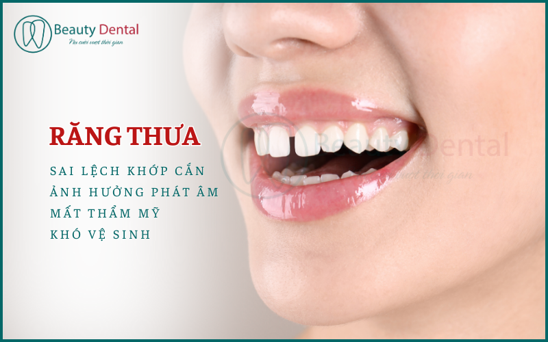 Ảnh hưởng của răng thưa đến đời sống