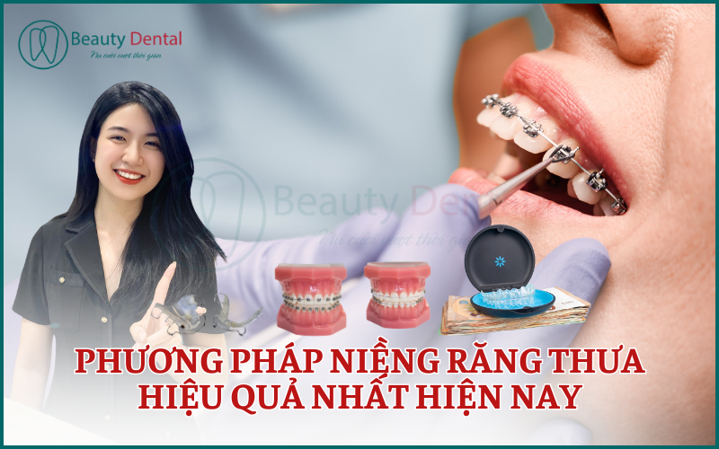 Phương pháp niềng răng thưa hiệu quả nhất hiện nay
