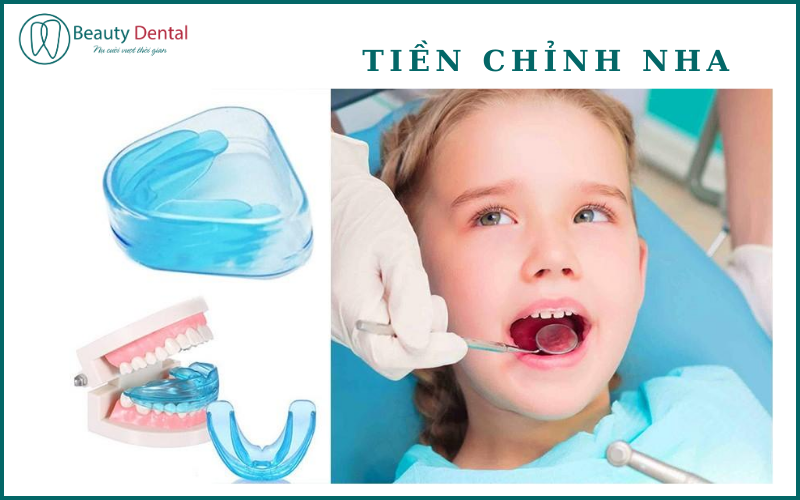 Tiền chỉnh nha - giai đoạn quan trọng, tạo cơ hội cho xương hàm và răng phát triển bình thường