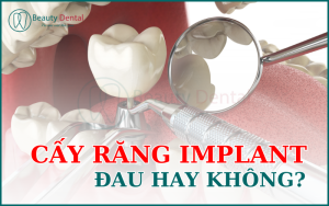 Trồng răng implant có đau không?