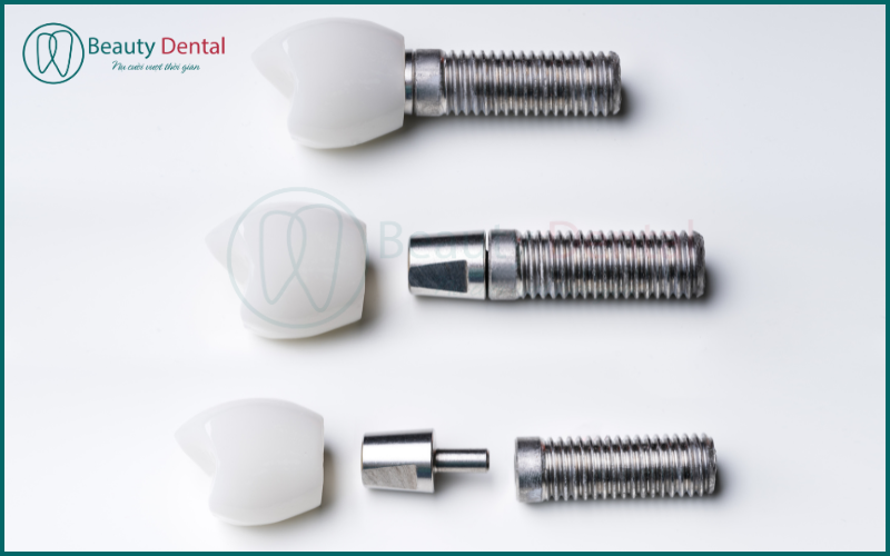 Cấy răng Implant có đau không? Nếu đau, phải làm sao?