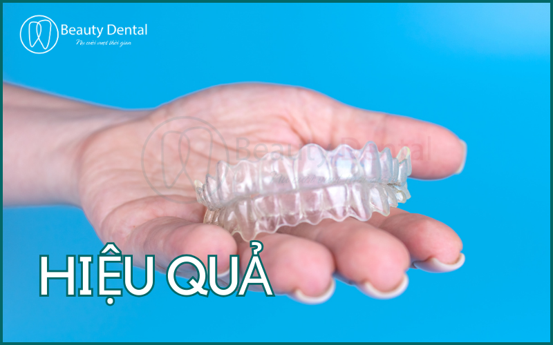 Invisalign - phương pháp niềng răng đem lại hiệu quả tối ưu