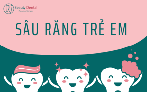 Sâu răng trẻ em - ngăn ngừa thật sớm